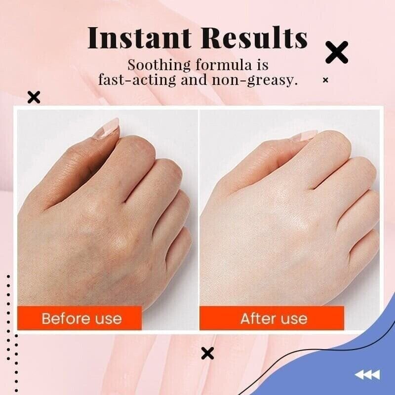 Hot Sale Hyaluronic Acid Hand Care Essence( 🔥Buy 1 Get1 Free🔥 )